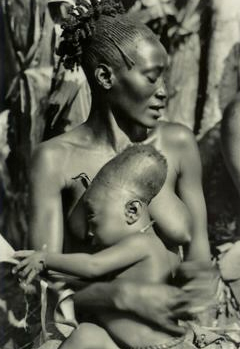 Акроцефалия в африканском племени мангбету