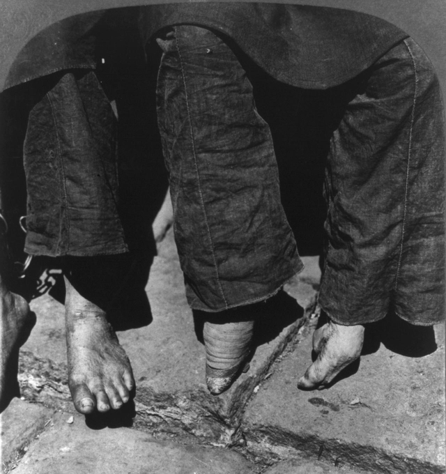Бинтование ног в Китае, фото 1902 года