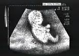 cartbaby