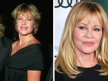 Мелані Гріффіт запідозрили у черговій пластиці — фото