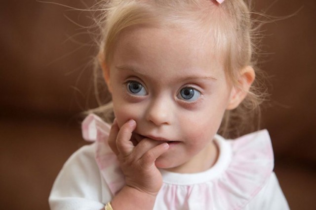 Улыбка 2-летней малышки Конни-Роуз с синдромом Дауна покорила мир моды