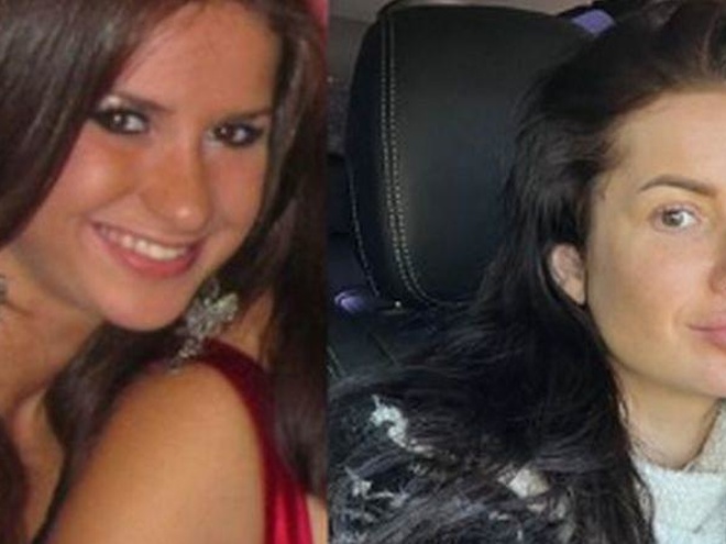 Шаманська зізналася, чи шкодує, що зробила пластичні операції