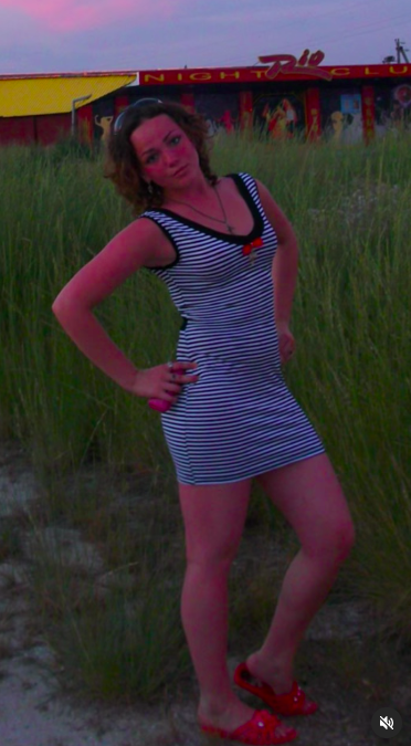 Марина Голд фото до похудения и пластики