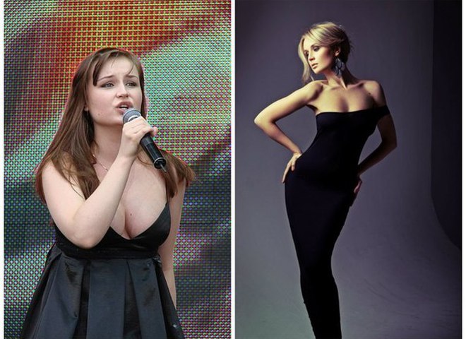 Полина Гагарина до и после операции