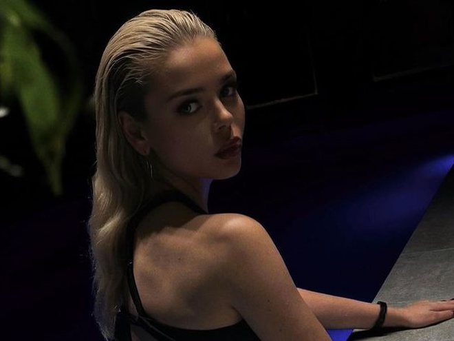 Аліні Гросу знадобилася допомога хірурга через травму на зйомках кліпу