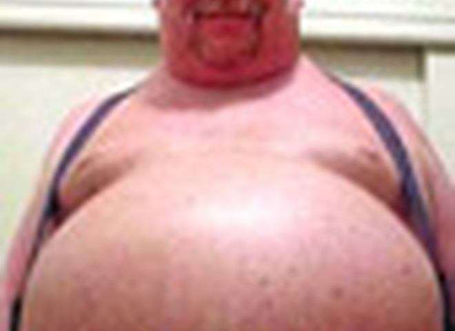 Хронический стресс стимулирует развитие ожирения