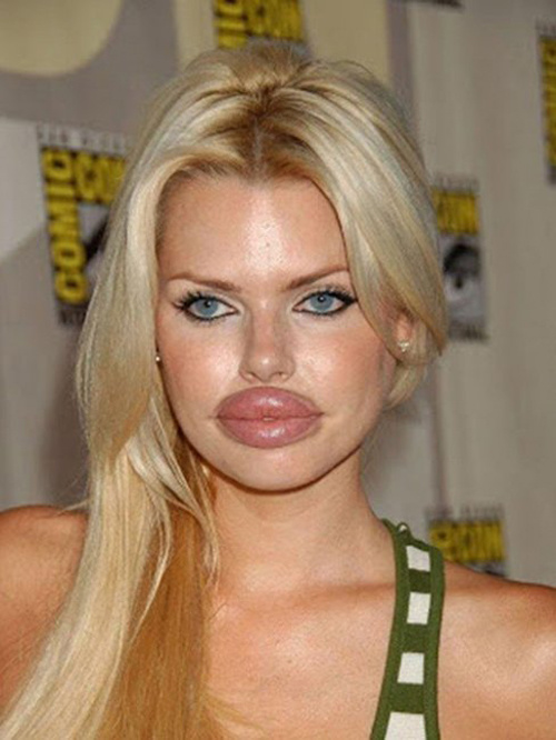 Губастые красавицы из социальных сетей