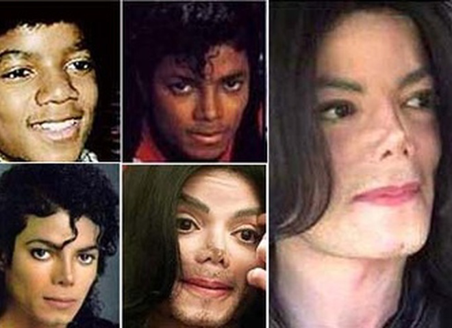Сентябрь 2004.
Газеты утверждают, что Майклу Джексону сделали новый нос