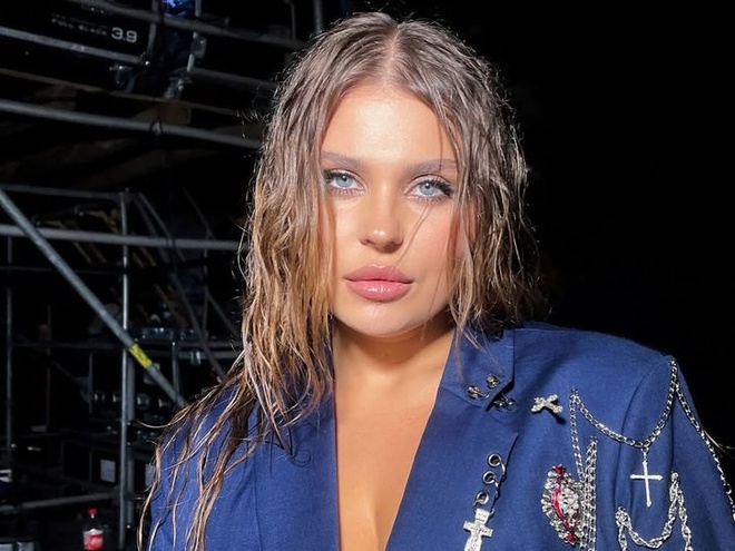 «Я хом'як»: Заріцька показала себе з набряками після видалення зубів мудрості