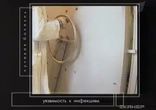 Лучевая болезнь