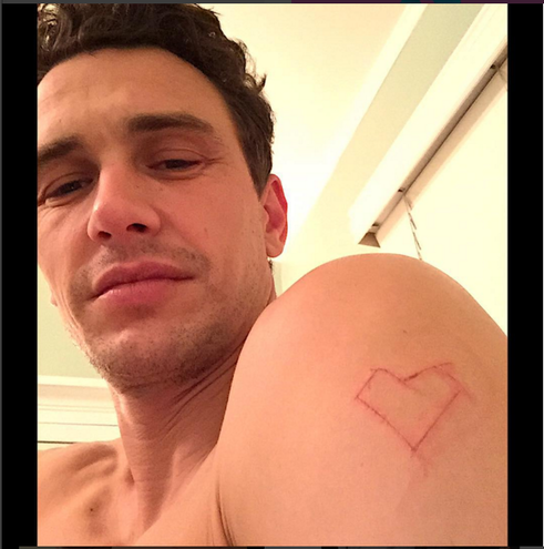 Джеймс Франко