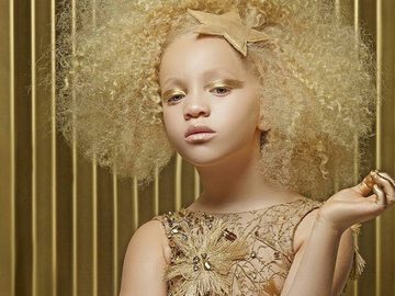 Девочка-альбинос Ава Кларк покоряет модельный бизнес