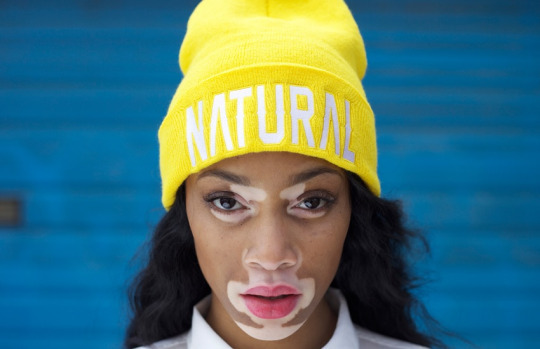 Вінні Харлоу