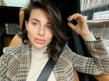 Скандальна блогерка Алхім зробила пластику обличчя у Дубаї