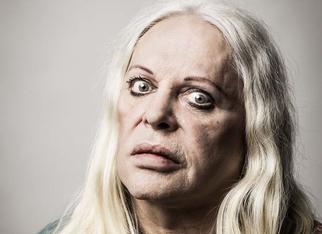 Дженезис Пі-Оррідж