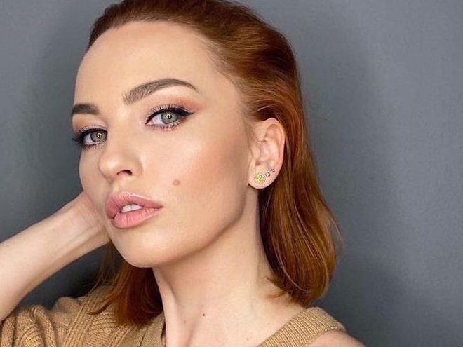 У зірки «Дизель шоу» Вікторії Булітко діагностували хворобу Лайма через місяць після укусу кліща