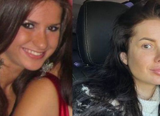 Шаманська зізналася, чи шкодує, що зробила пластичні операції