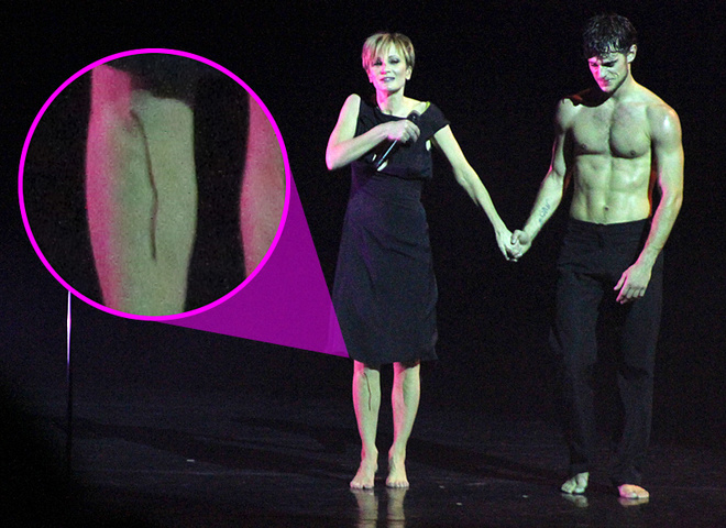 кровь с колена Каас