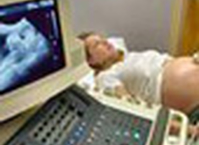 Компьютер подскажет, каким способом рожать