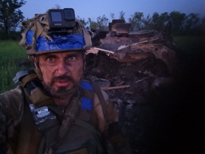Режисер і боєць ЗСУ Олег Сенцов потрапив до лікарні з контузією