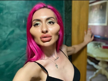 Власниця найбільших вилиць України показала себе до пластики - фото