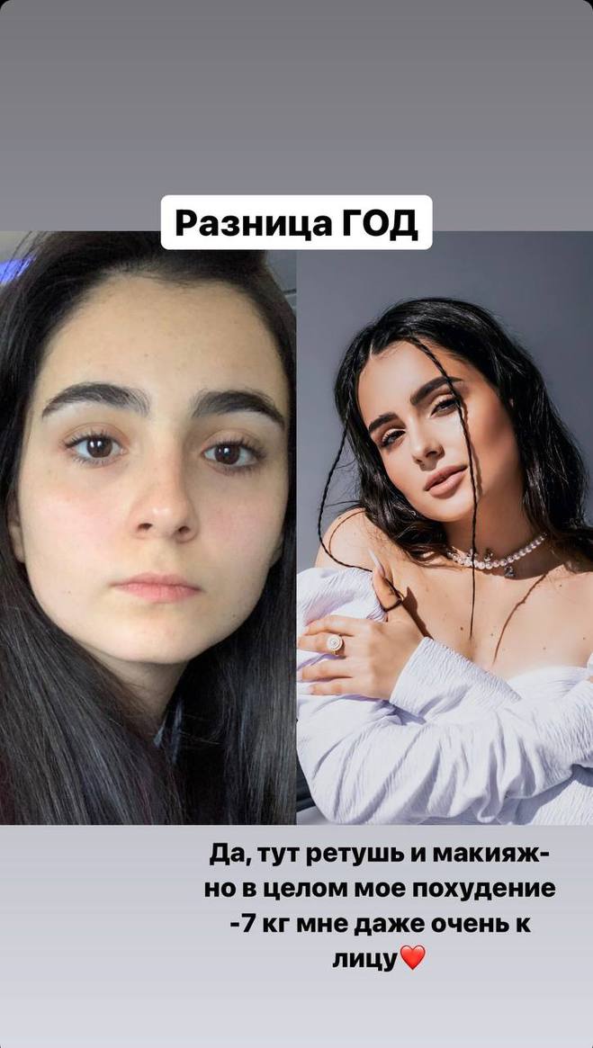 Анна Тринчер до и после похудения