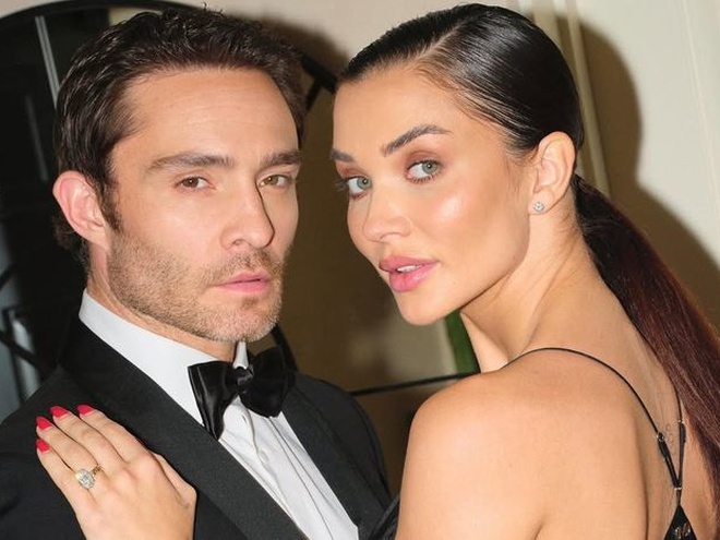 У зірки «Пліткарки» Еда Вествіка народився первісток