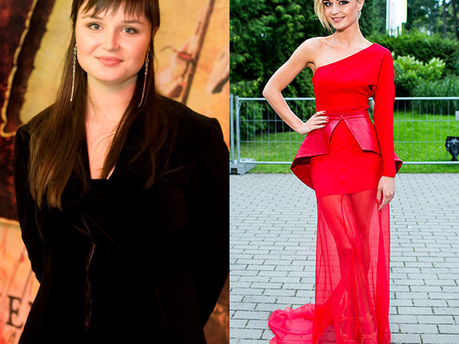 Поліна Гагаріна до і після операції