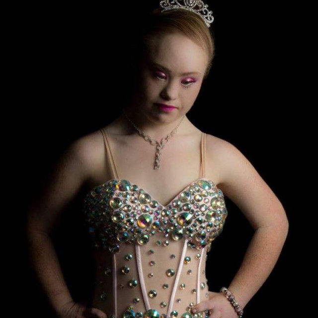 Девушка с синдромом Дауна стала моделью