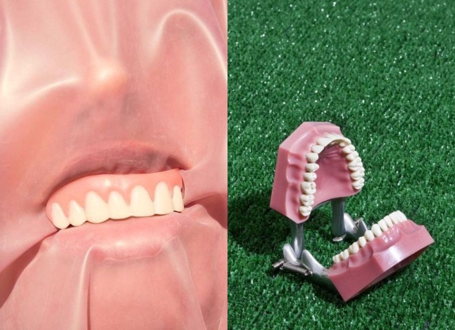 Зубний треш-тренд з TikTok #teethfilingchallenge