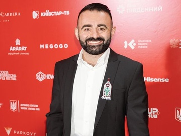 Зірка «Скаженого весілля» Арам Арзуманян переніс операцію після травми на сцені
