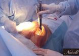 Маммопластика http://estheticcenter.ru