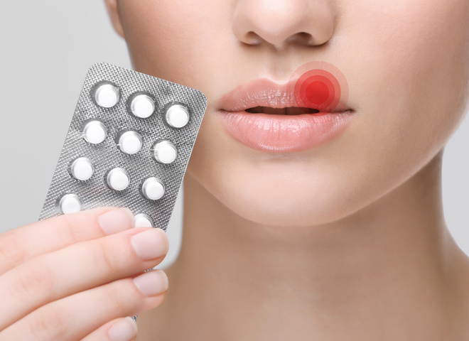 Вопрос-ответ: как лечить герпес?