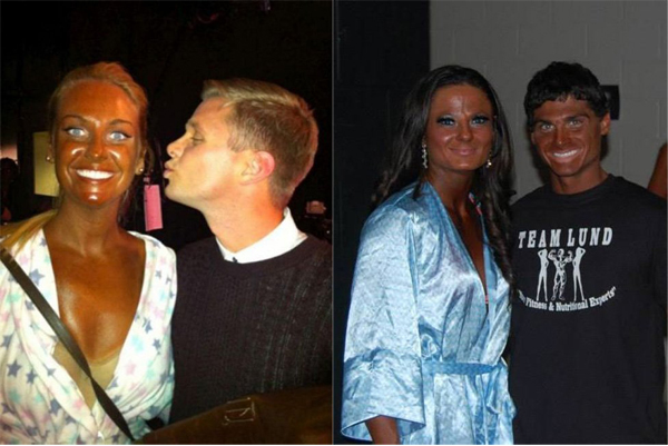 Передоз с автозагаром