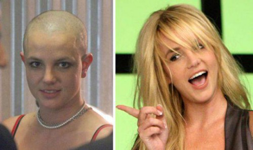 Лысые знаменитости