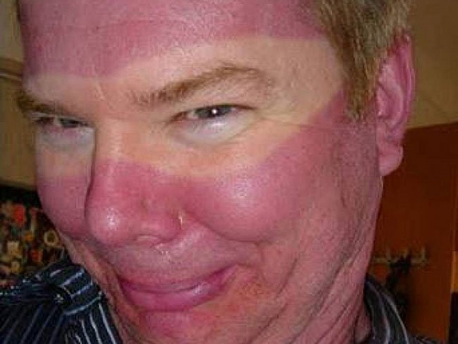 Как не стоит загорать