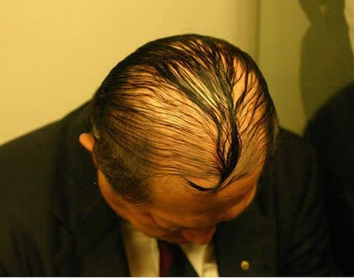 Лысину не спрячешь